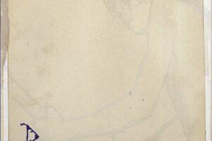 Babyshambles – Down In Albion (20th Anniversary Edition): Album Review